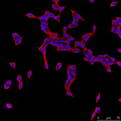 Early stage prostate cancer cells